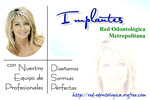 Implantes dentales