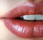 blanqueamiento dental
