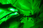 Greenlight Laser para Prostata